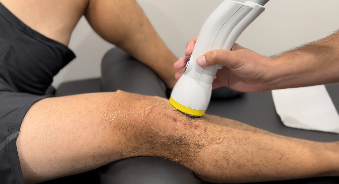 Meniscus Tears and Knee Injuries: How SoftWave Tissue Regeneration Therapy Supports Recovery in Maui with Dr. 808 Meniscus Tears and Knee Injuries: How SoftWave Tissue Regeneration Therapy Supports Recovery in Maui with Dr. 808